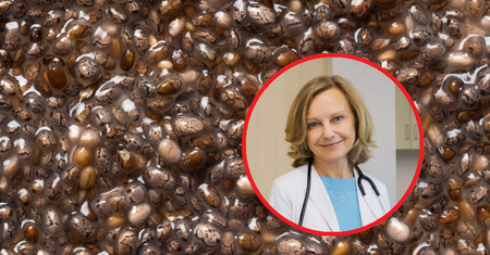 Kardiolog zdradza, jak ujarzmić wysoki cholesterol. Na liście 5 kluczowych produktów