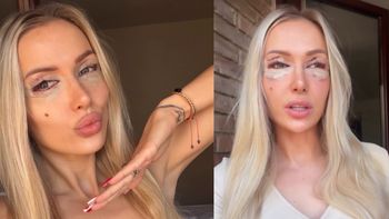 Eliza Trybała poddała się PLASTYCE POWIEK! Zainspirowała się znaną koleżanką: "Miała dokładnie ten efekt, który chciałam uzyskać"