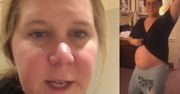 Amy Schumer podzieliła się filmem, na którym WYMIOTUJE. "Wyłączcie dźwięk, jeśli macie wrażliwe żołądki" (WIDEO)