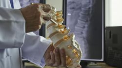 Sekwestracja - definicje i charakterystyka. Sekwestracja płuc i dysków