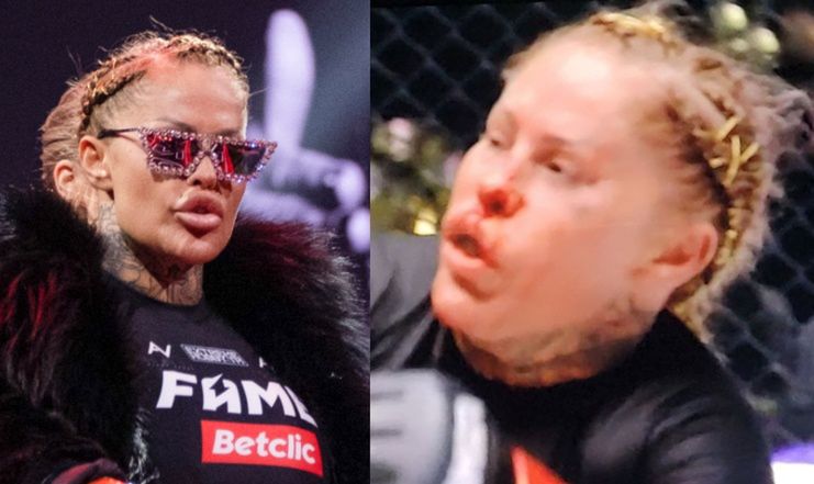 Laluna Unique i jej SKWASZONY NOS przegrywają walkę na Fame MMA