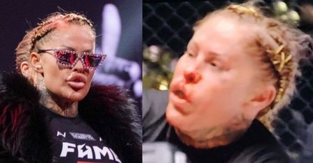 Laluna Unique i jej NOS Z TURECKIEJ KLINIKI przegrywają walkę na Fame MMA (ZDJĘCIA)