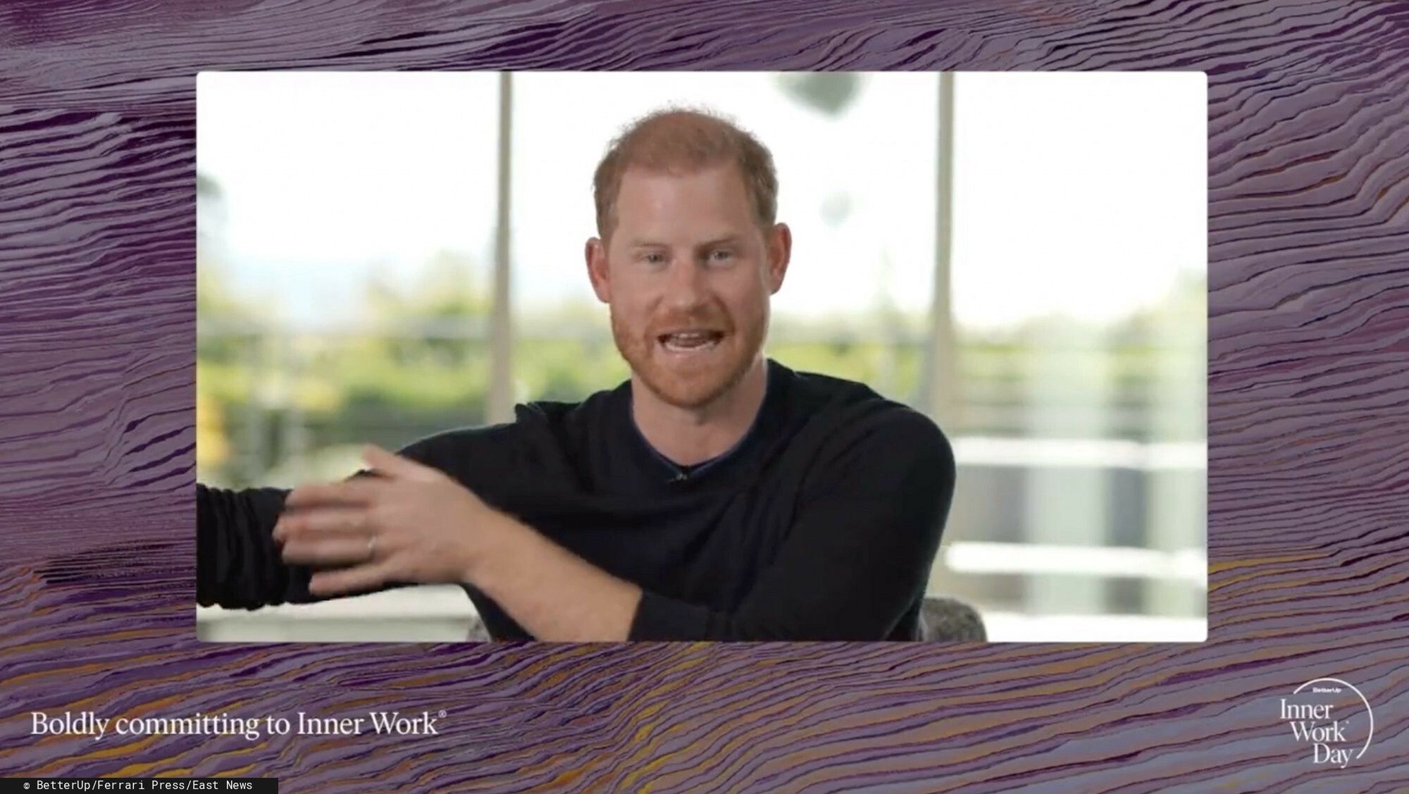 Książę Harry zrobił sobie botoks? 