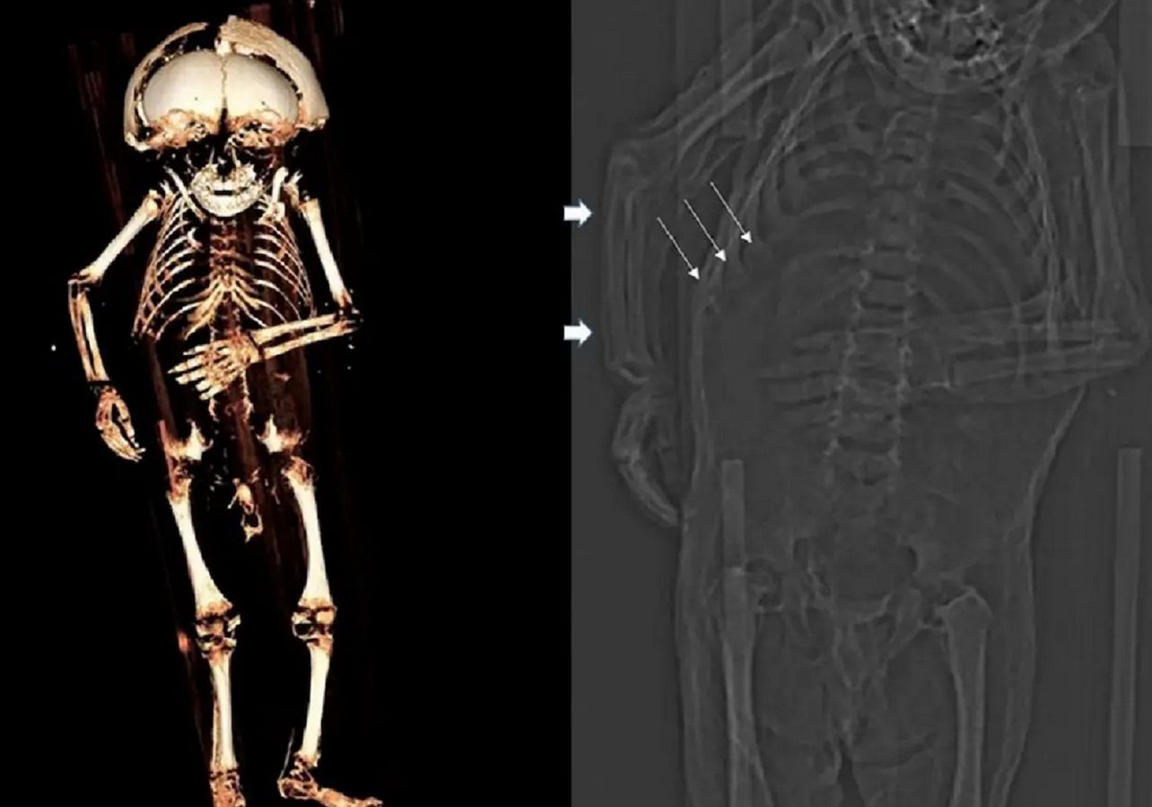 Odnaleźli mumię dziecka. Przyczyna śmierci nimi wstrząsnęła