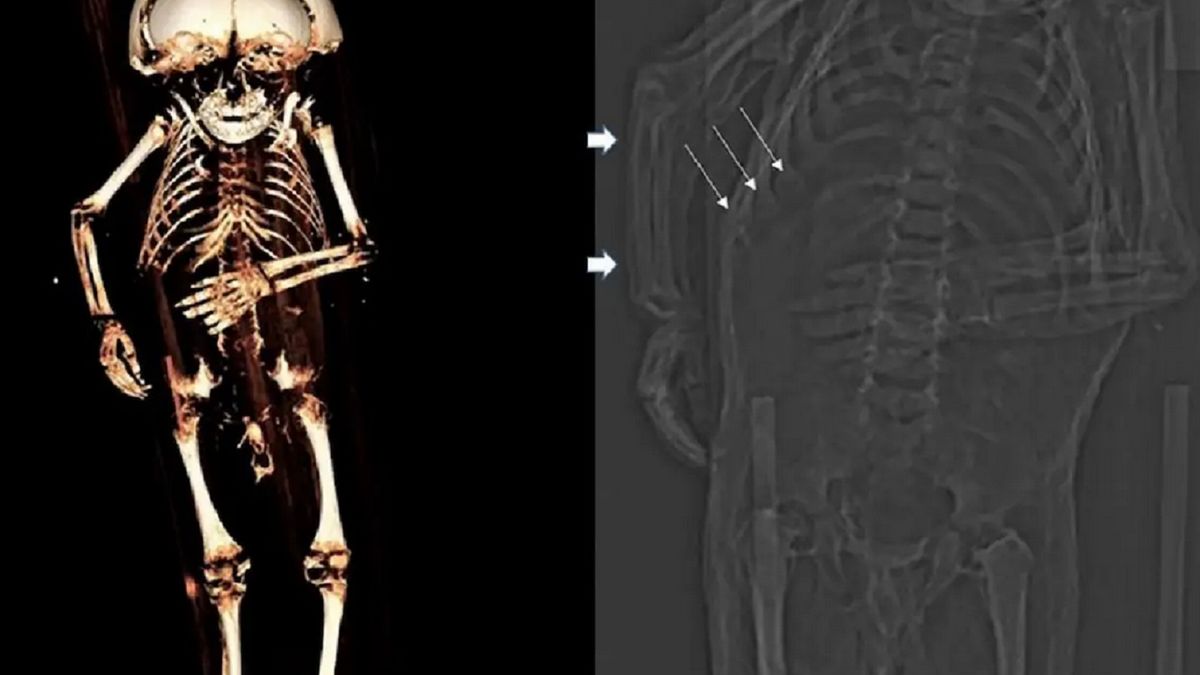 Zwłoki dziecka kompleksowo przebadano.