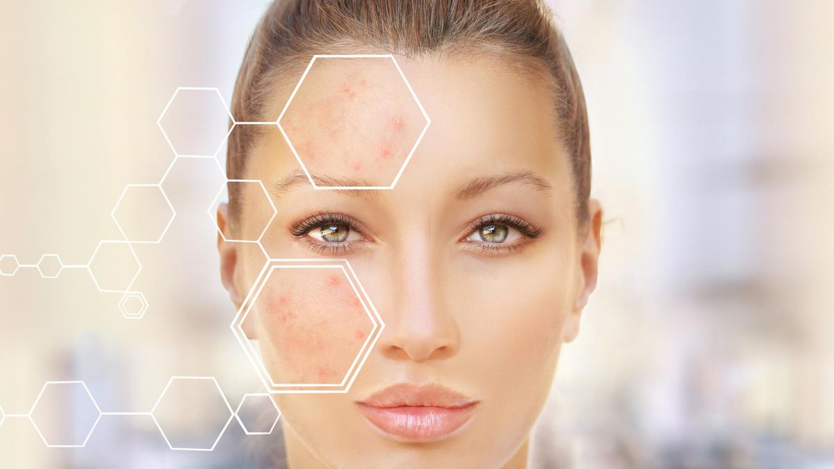 Olejek pichtowy cieszy się coraz większą popularnością, również w Polsce.