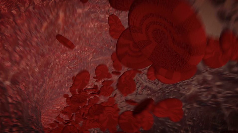 Robią ci się często siniaki? To może być małopłytkowość (WIDEO)