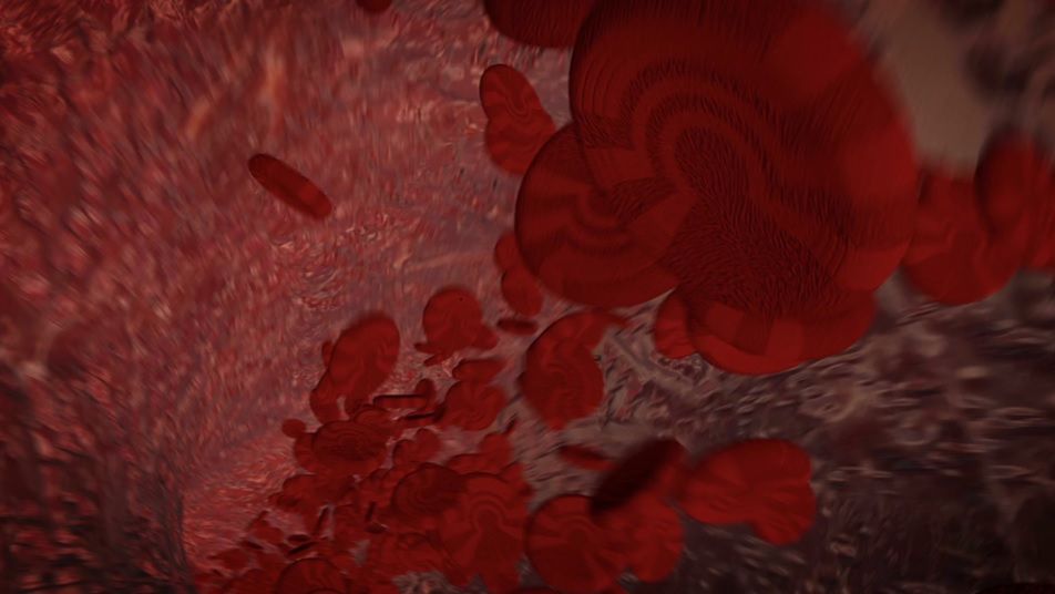 Małopłytkowość to poważne schorzenie krwi. Nie lekceważ jej objawów