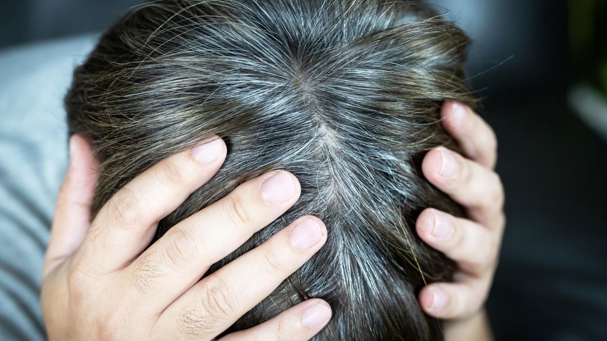 Siwiejące włosy, wypadanie - to mogą być oznaki hipercholesterolemii