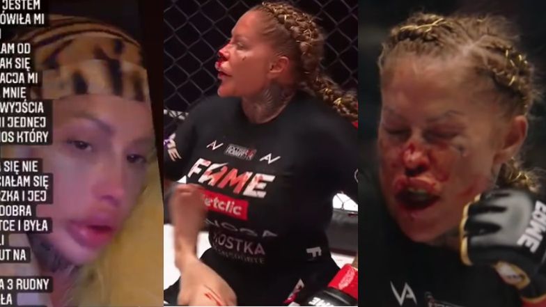 Laluna ubolewa nad złamanym nosem i atakuje swoją przeciwniczkę