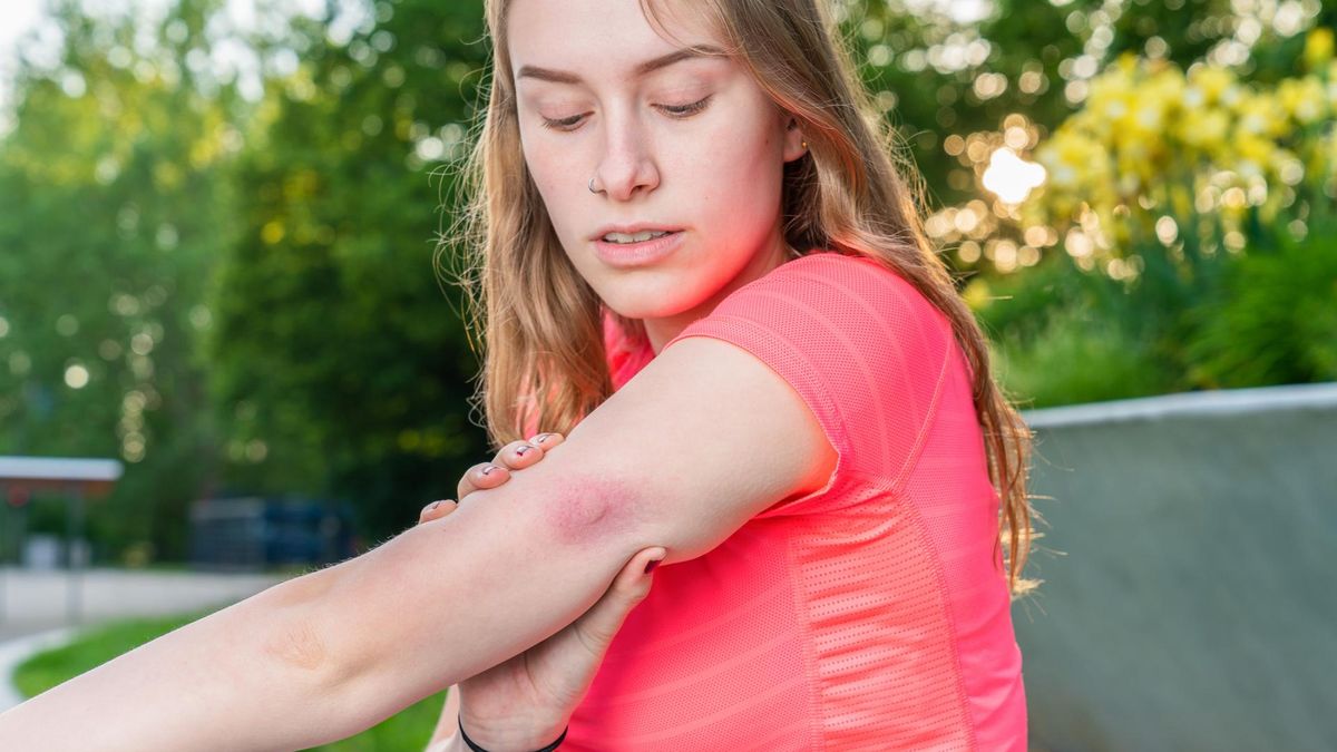 Ukąszenia niektórych owadów mogą być groźne