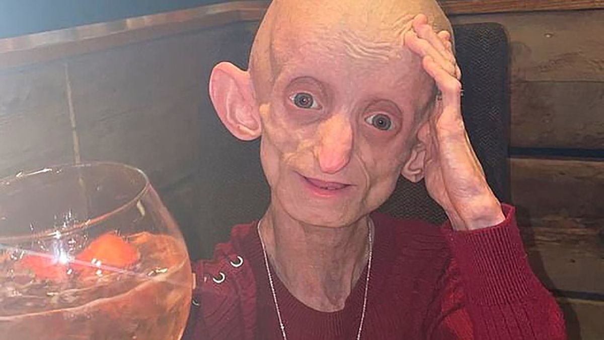 18-letnia Ashanti Smith miała biologicznie 144 lata