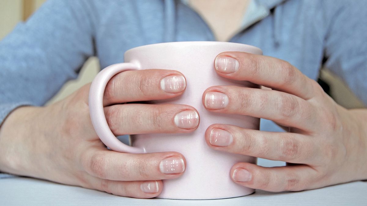Białe plamki na paznokciach mogą wskazywać na szereg problemów zdrowotnych