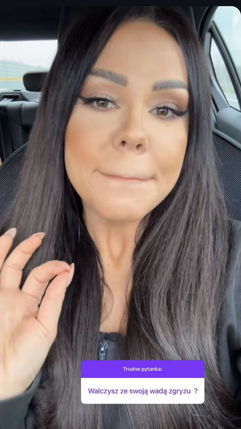 Sylwia Bomba tłumaczy fance, czemu nie walczy z wadą zgryzu