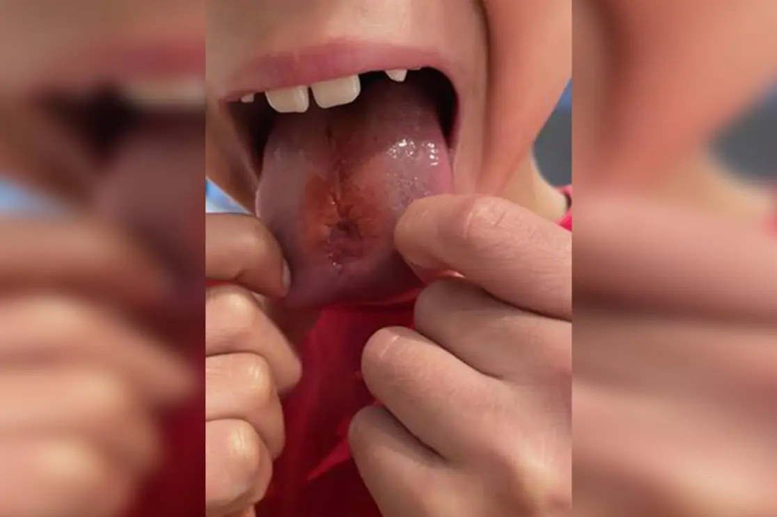 Niektóre cukierki mogą być bardzo niebezpiecznie dla dzieci