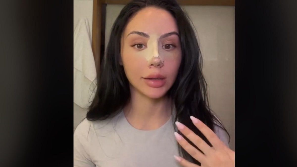 Zrobiła sobie "nos Barbie". Tak reaguje na hejterskie komentarze. 