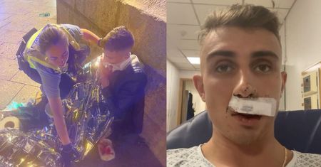 Olimpijczyk ofiarą brutalnego ataku w centrum miasta. Teraz czeka na operację