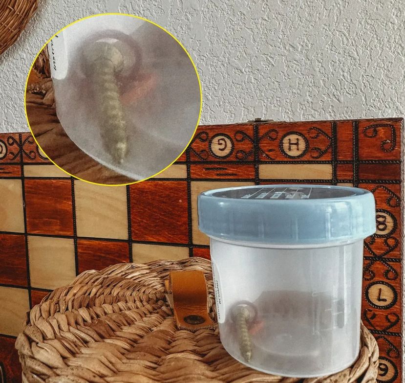 Zaburzenie Charliego prowadzi do niebezpiecznych incydentów