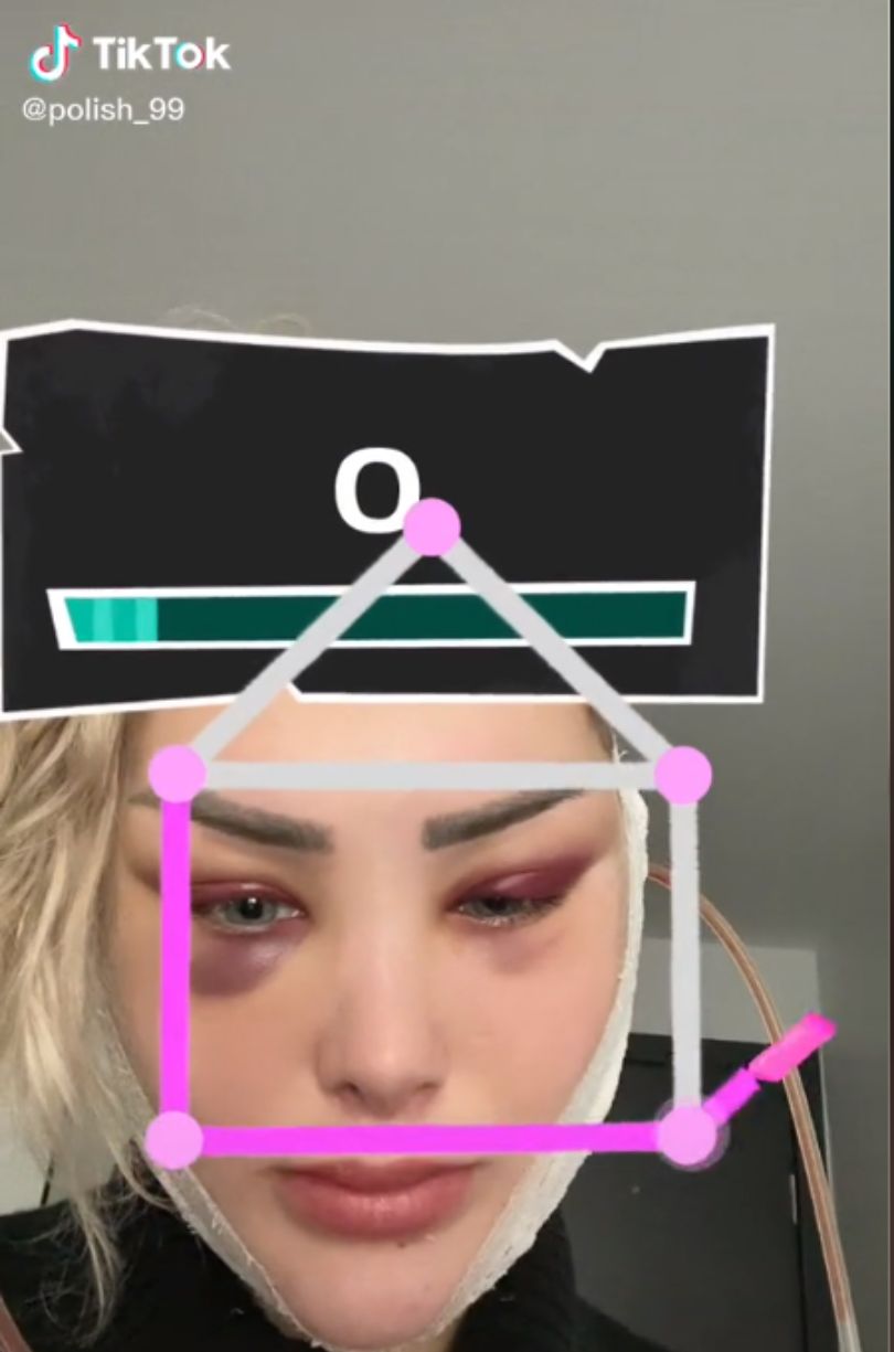 Tiktokerka wspomina dramat podczas lotu samolotem po zabiegach