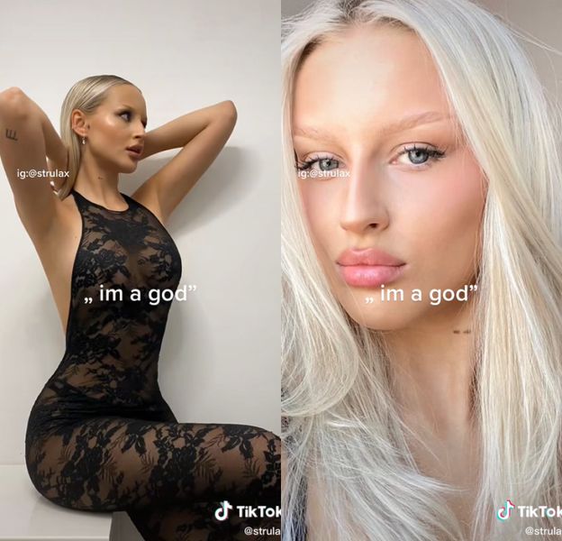 dziewczyna-fabija-skiego-ma-powi-kszone-usta-tak-kiedy-wygl-da-a