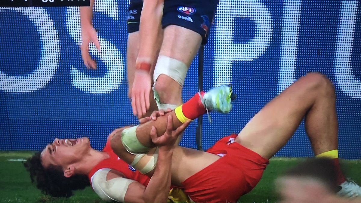 Wil Powell doznał fatalnej kontuzji 