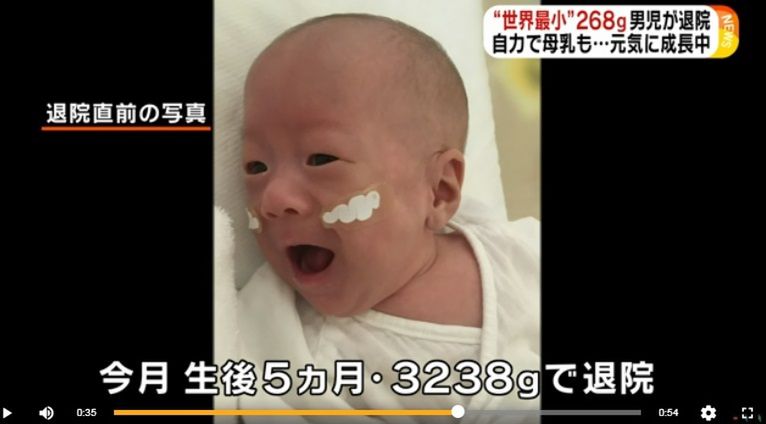 Maluch z 24. tygodnia ciąży waży już ponad 3 kg