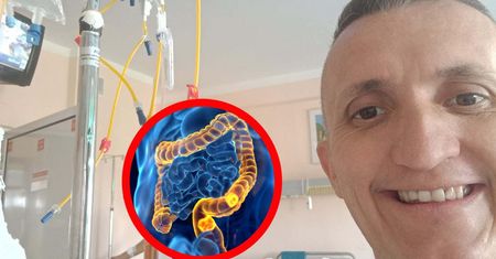 Pierwszy objaw nie przestraszył Pawła. Rak zajął już jelita, wątrobę