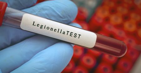 Legionella w Polsce. Władze nie wdrożyły unijnej dyrektywy