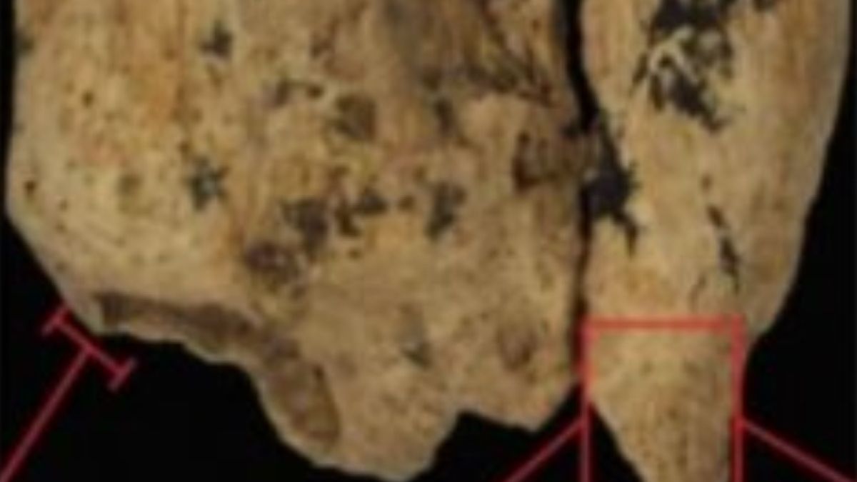 Sensacyjne odkrycie archeologów. To 31 tysięcy lat temu doszło do pierwszej amputacji chirurgicznej?