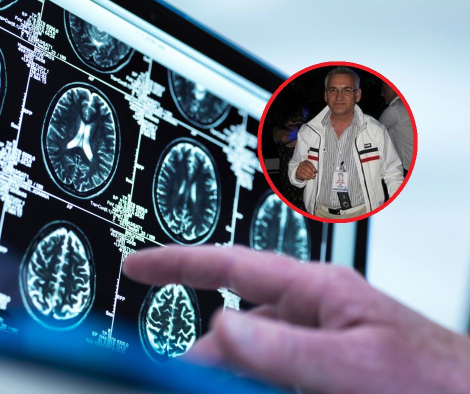 To dlatego mózg szybciej się starzeje. Lekarz ostrzega