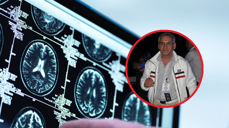 Przez takie zachowania mózg szybciej się starzeje
