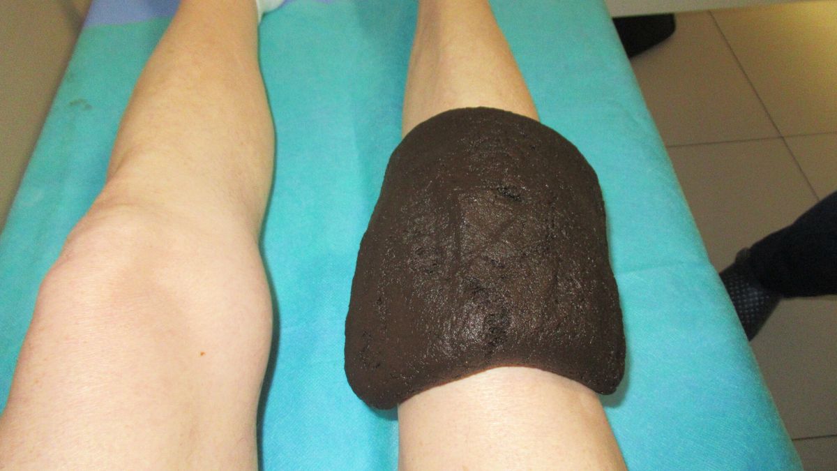 Dostępność świadczenia jest ograniczona i podlega decyzji NFZ