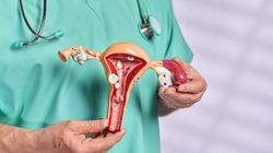 Atonia macicy - przyczyny, objawy, leczenie