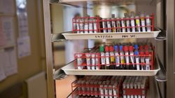 Grupa krwi może mieć związek z chorobą. Naukowcy wyjaśniają