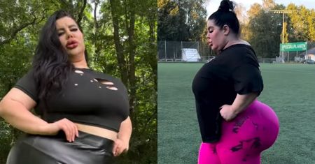 Influencerka aspiruje do posiadania NAJWIĘKSZYCH POŚLADKÓW na świecie. Na operacje wydała już pół miliona złotych