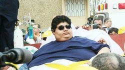 Najgrubszy człowiek świata - kim jest, leczenie otyłości olbrzymiej