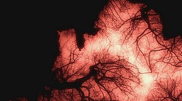 Naczynia krwionośne uzyskane z komórek mięśniowych nieboszczyka 1