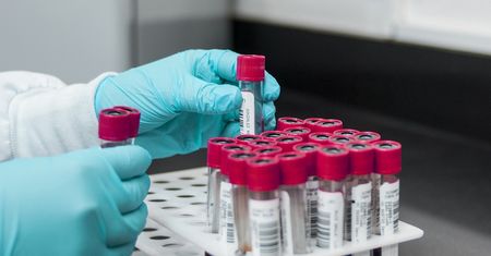 Polski lek na koronawirusa. Biomed wystartował z produkcją