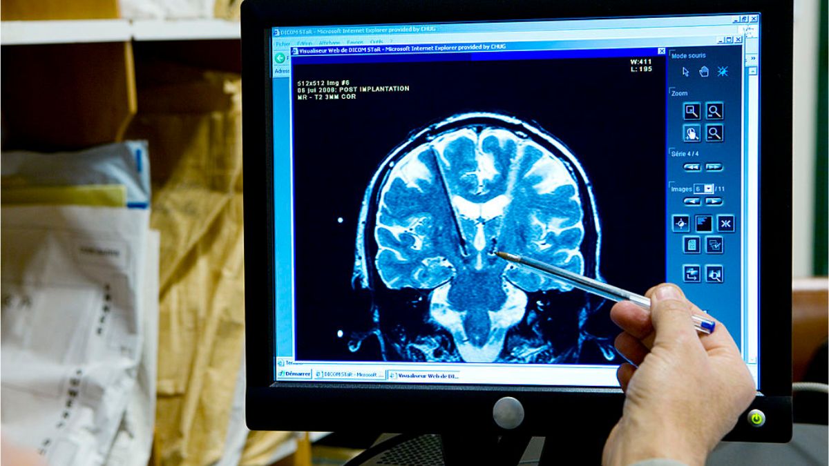 mozg tasiemiec zdrowie 