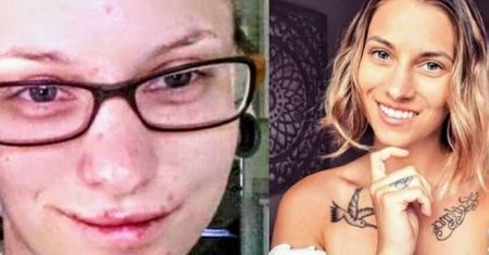 Narkomanka przeszła metamorfozę. Jest nie do poznania