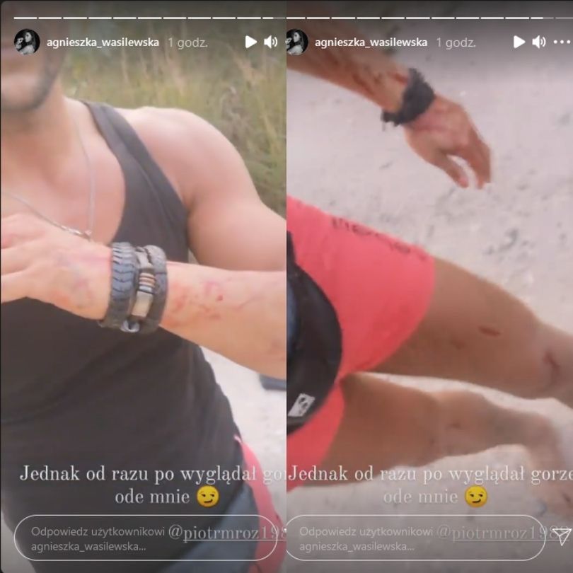 Piotr Mróz miał wypadek samochodowy. Jego ukochana zrelacjonowała zdarzenie w sieci