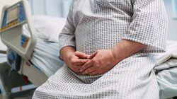 Pierwsza taka operacja bariatryczna w Kielcach. Pacjent ważył 230 kilogramów