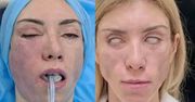Rosyjska miss zrobiła sobie lifting. Efekty są przerażające