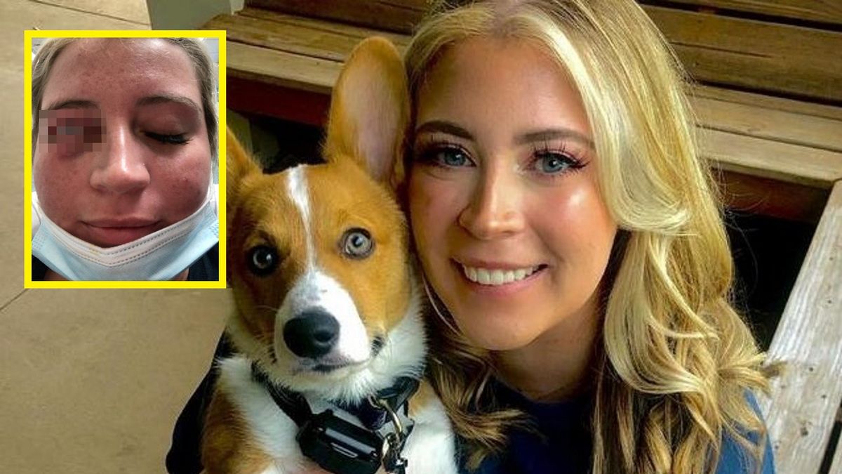 Kelsey Salmon z Georgii w USA.