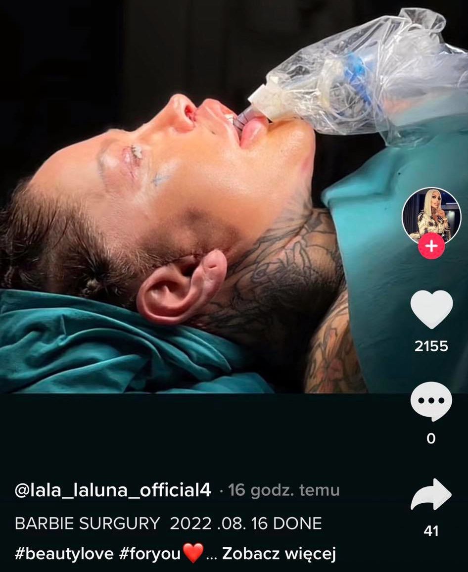 Operacja Laluny Unique