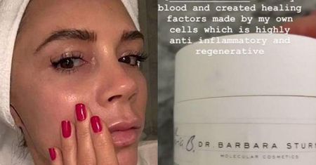 Victoria Beckham używa kremu z własną krwią za... prawie 6 tysięcy złotych