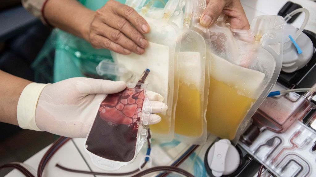 Według najnowszego badania terapia osoczem nie zmniejsza liczby zgonów na COVID-19