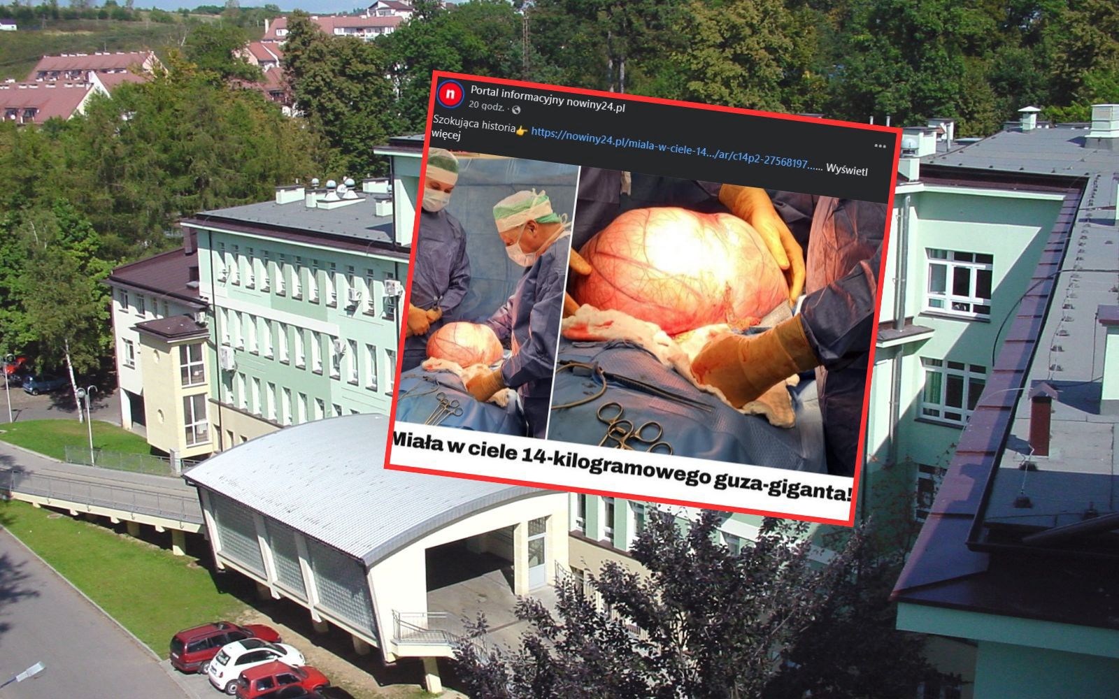 Kobiecie wycięto guza o masie 14 kg