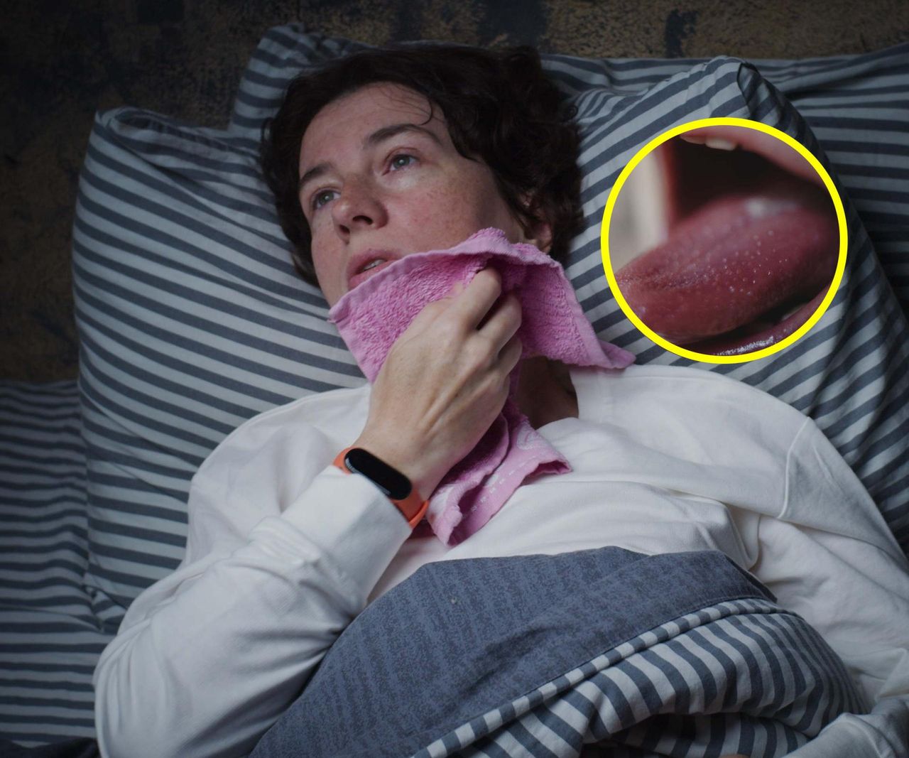 Objawem jest malinowy język. Od początku roku już 32 tys. zachorowań