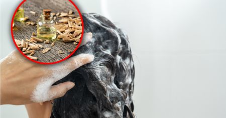 Dodaj kilka kropel do szamponu. Pozbędziesz się uciążliwego problemu